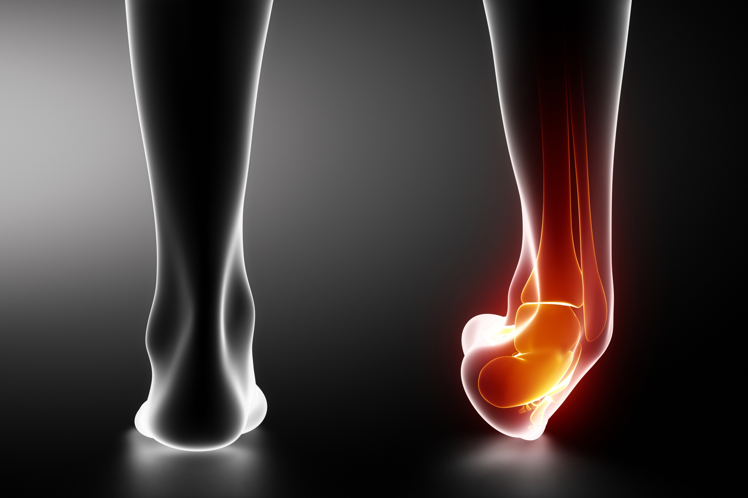 Preventing Recurrent Ankle Sprains - The Physio Company