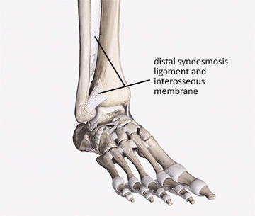 Top 10 myths about ankle sprains - Shepp Physio & Podiatry