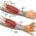 gv physio tennis elbow